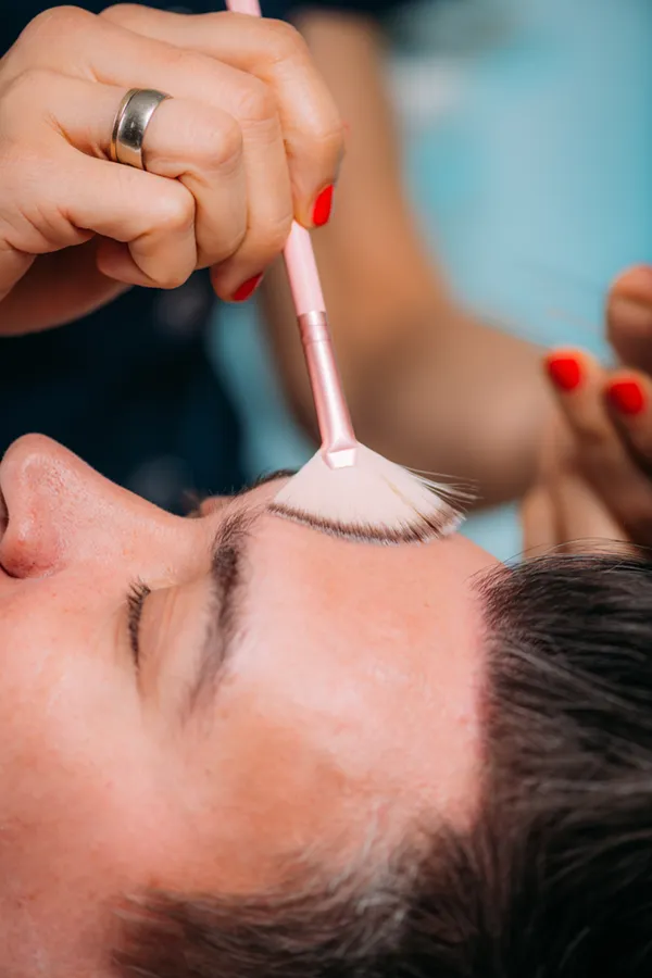Close-up of a man receiving a chemical peel treatment on his forehead from professional who work with ProCare Wellness Institute on Virginia Beach.