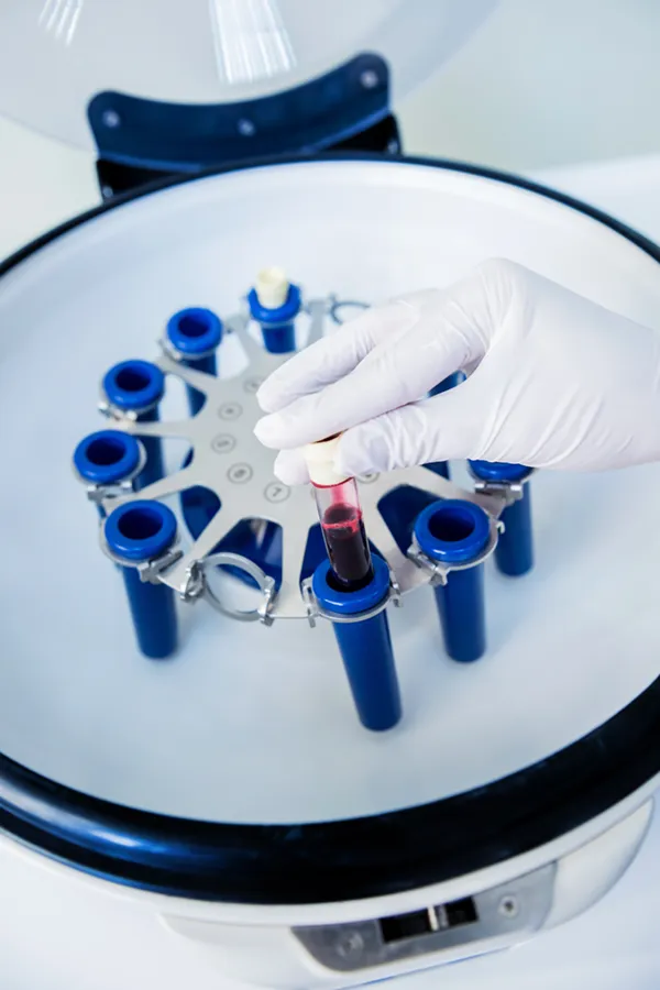 A centrifuge with vials of plasma in a medical lab, representing Platelet Rich Plasma, or PRP, therapy from ProCare Wellness Institute in Virginia Beach.
