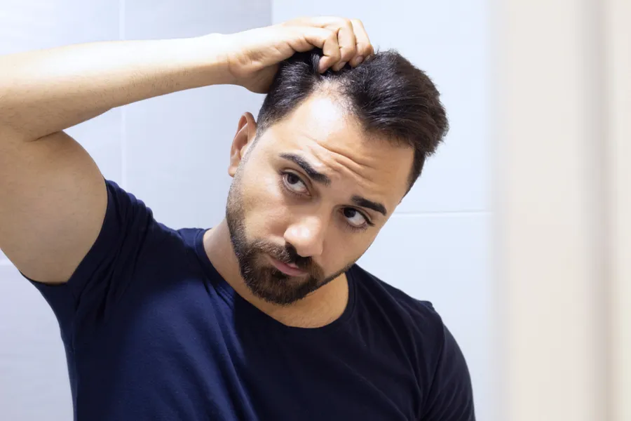 A man in a navy t-shirt looks in the mirror worrying about and touching his receding hairline, considering hair loss and restoration treatment from ProCare Wellness Institute in Virginia Beach.